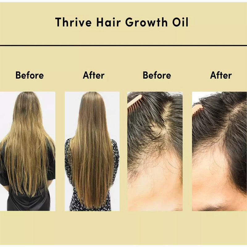 Hair Essential Oil Improve Dryness And Irritability And Nourish My Store