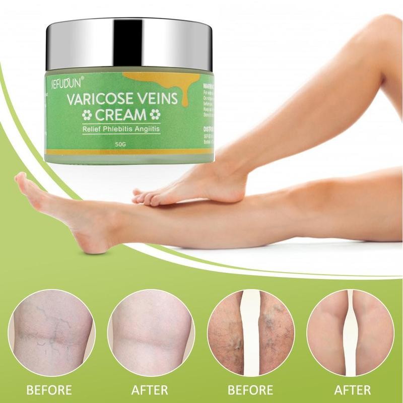 Vein Cream Red Blood Streaks Repair Earthworm Leg Bruises Bulge Relief Pain Safflower Skin care lotion Varicose Cream My Store